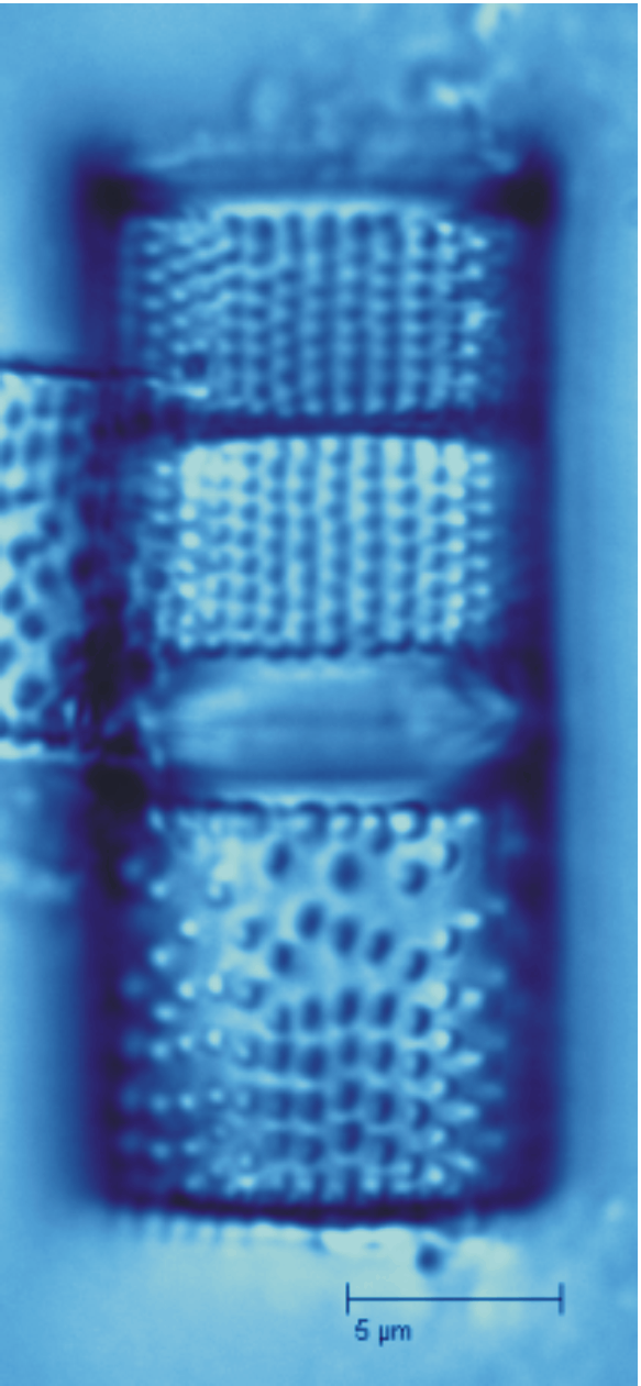 Aulacoseira islandica