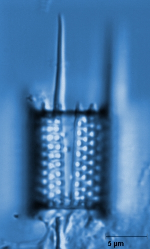 Aulacoseira granulata