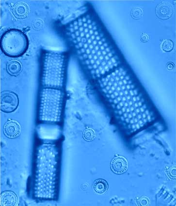 Assortment of diatoms