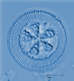 Cyclotella antiqua