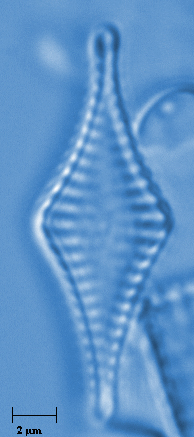 Fragilaria parasitica