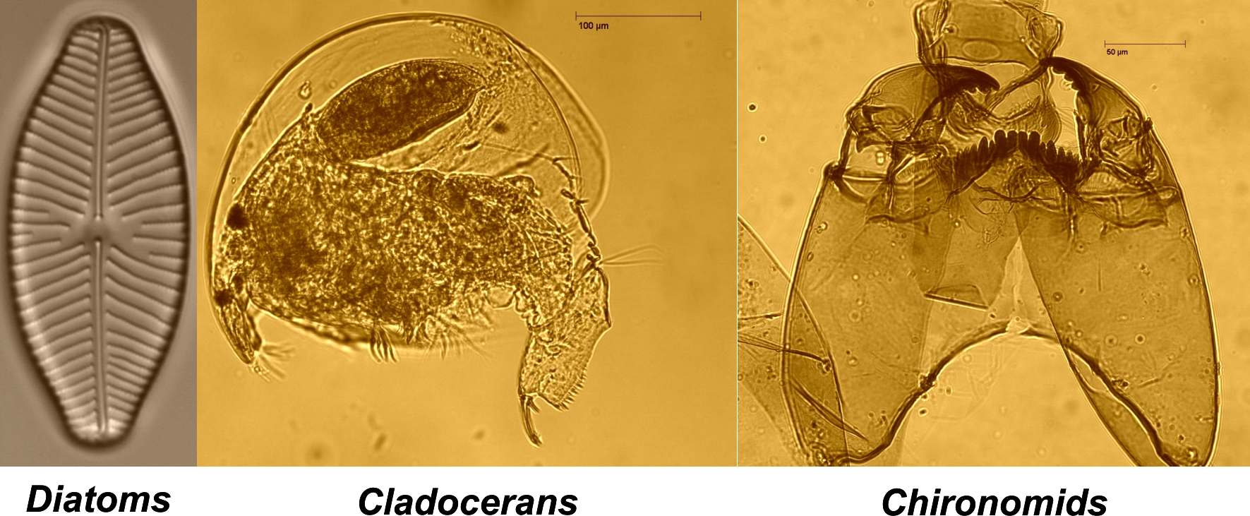 paleolimnological indicators: diatoms, cladocerans, chironomids
