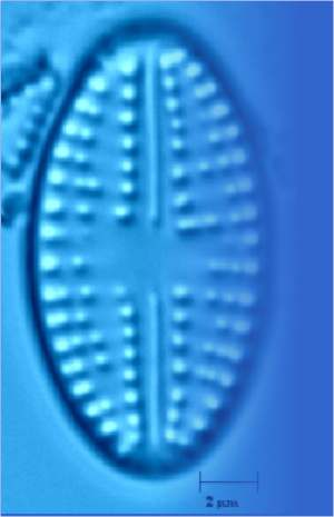 Lake of the Woods, Paleolimnology, Diatom taxonomy