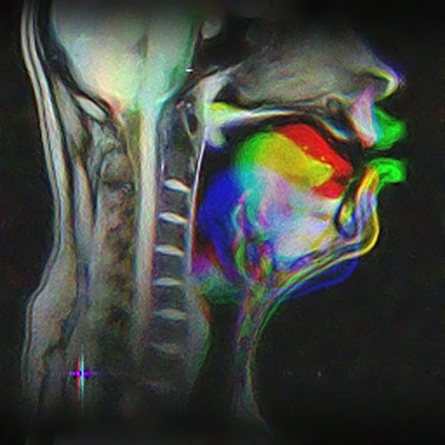 fMRI image of profile of human head with coloured area depicting mouth and throat movement during speech