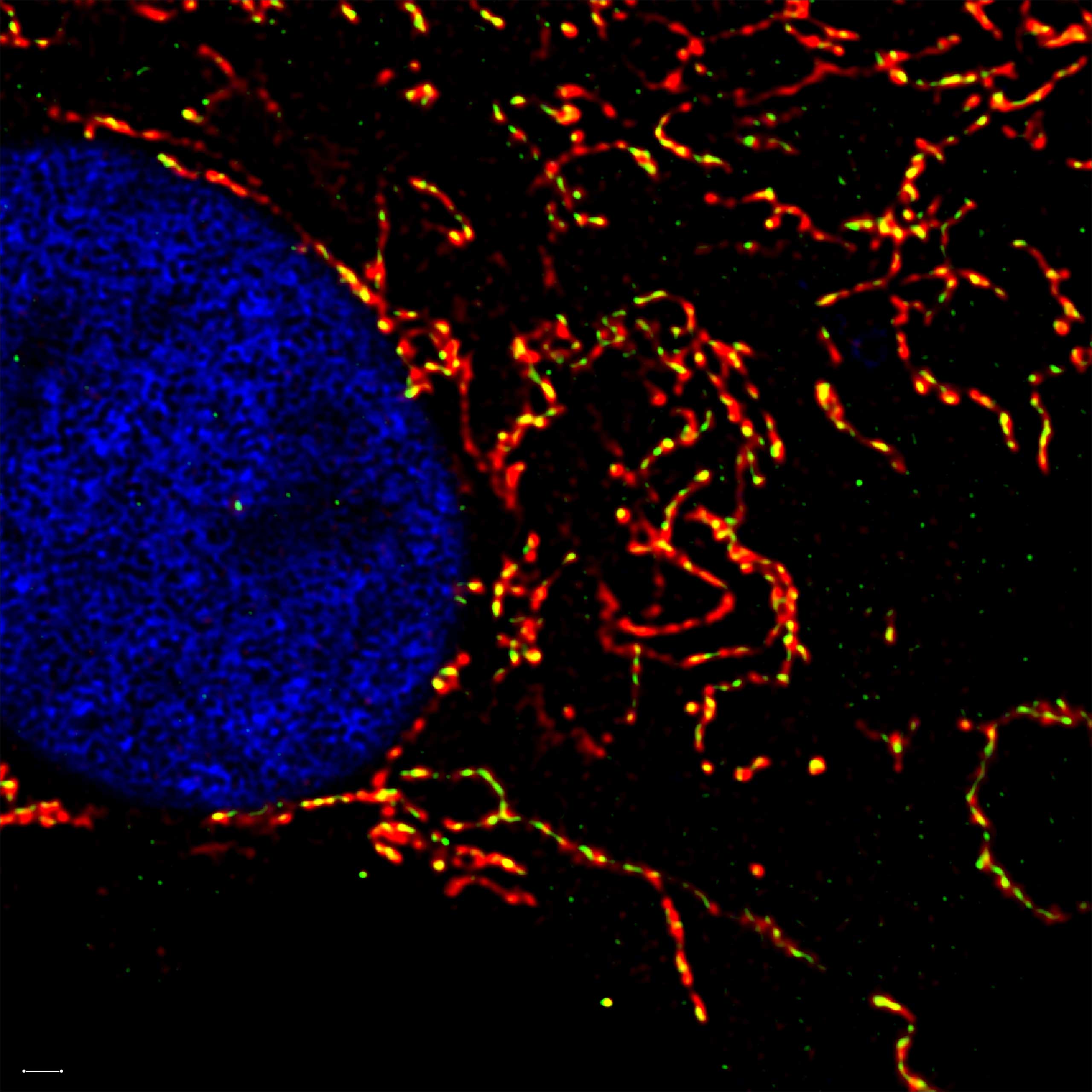 Mapping Mitochondrial Complex I