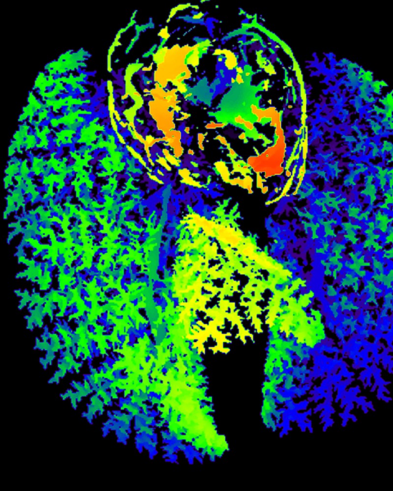 Queen's Art of Research photo contest winner: The Tiniest Tree of Life by Dr. Elahe Alizadeh, Staff (Queen's CardioPulmonary Unit [QCPU]), Queen's University.