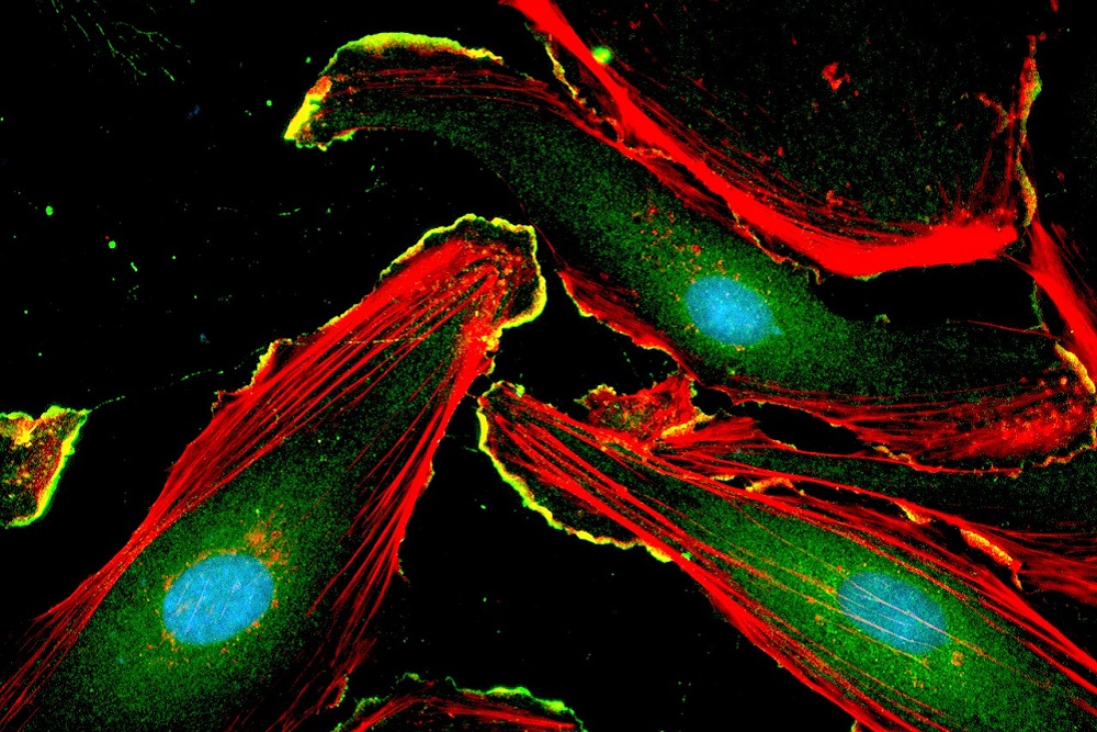 [Art of Research photo of DNA under the microscope]