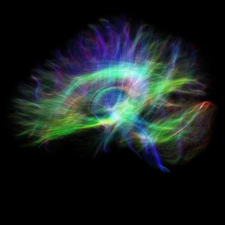 Green and blue waves showing Diffusion Spectrum Imaging from an MRI