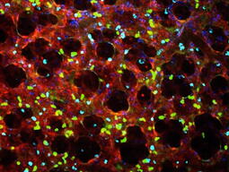 a microscopic view of lung cells