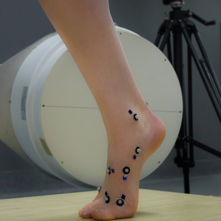 Ankle in flexion in front of a camera 