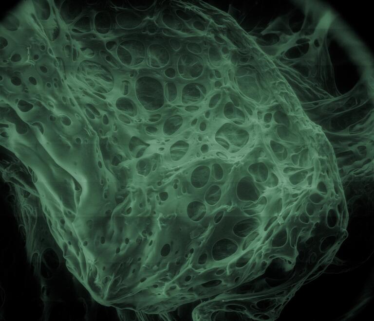  Water-swollen hydrogel particle under a microscope